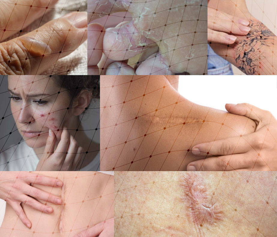 Claves para la Reparación Cutánea